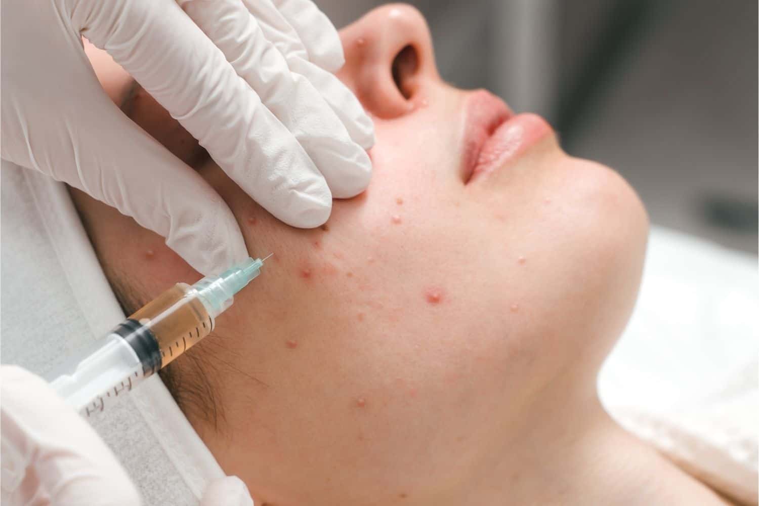 Top 10 Acne Clinic in Putrajaya