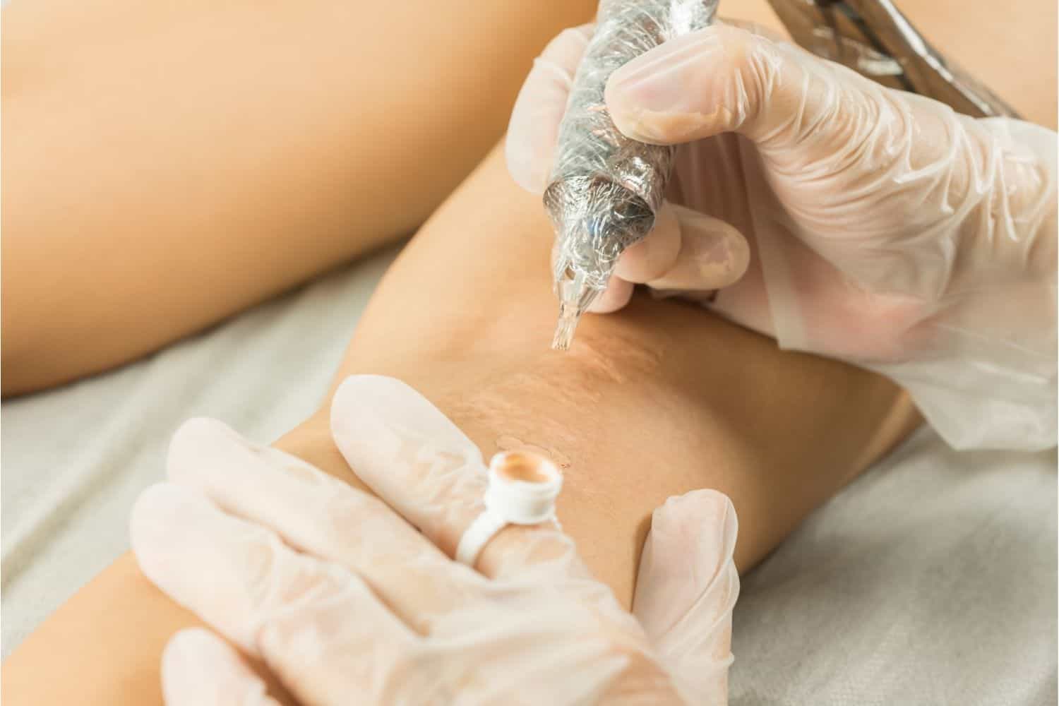 Top 10 Acne Clinic in Puchong